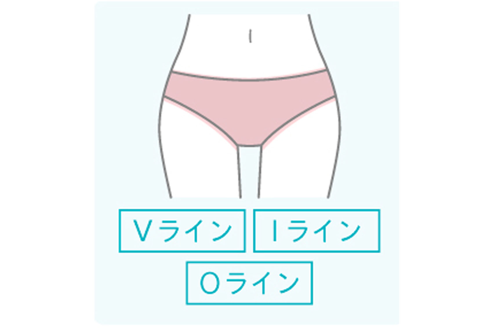 エミシアクリニックのVIO脱毛の範囲画像です。